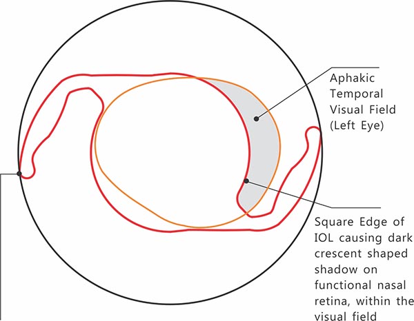 c-loop