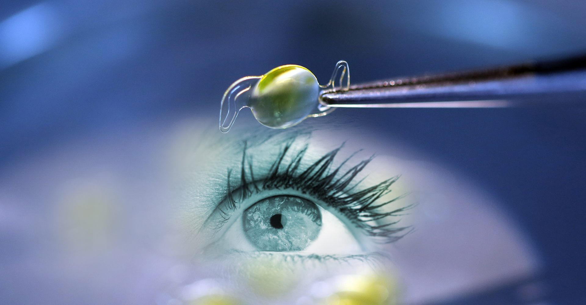 Precision Vision